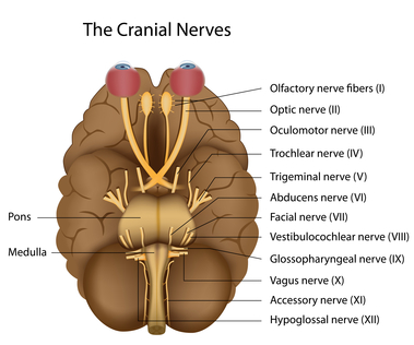 cranial neuropathy