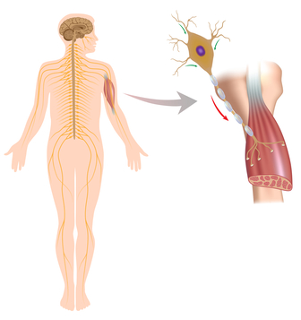 motor nerve damage