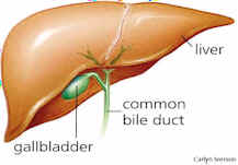 gallbladder stones