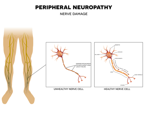 help neuropathy