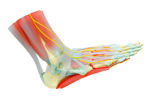 Plantar Fasciitis