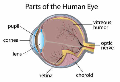 optic neuropathy