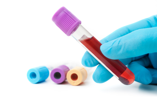 blood test shows high B12