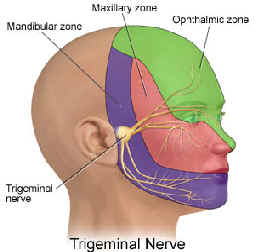 Trigeminal neuralgia