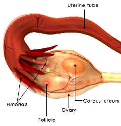 PCOS